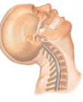 Whiplash Graphic showing whipping motion