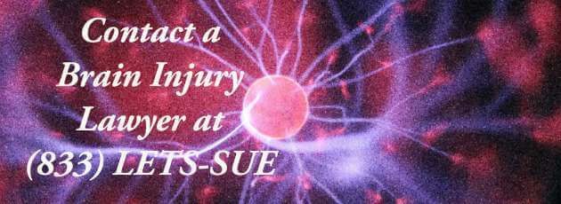 wp-content/uploads/brain-injury-lawyer-lets-sue.jpg